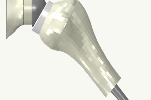 Mechanical trade-offs in changing centers of rotation for reverse shoulder arthroplasty design