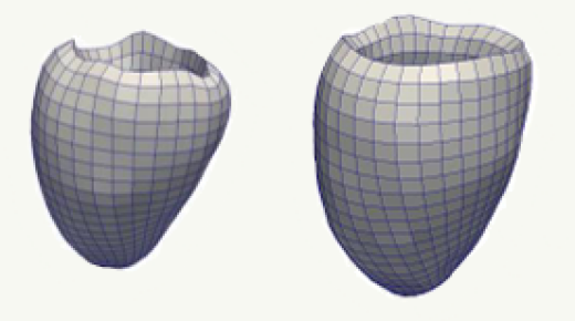 Abaqus/Standard-based quantification of human cardiac mechanical properties