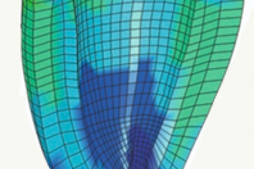 Patient-Specific Modeling of the Cardiovascular System